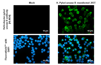 Anti-Helicobacter pylori urease B antibody [HL4834] used in Immunocytochemistry/ Immunofluorescence (ICC/IF). GTX644897